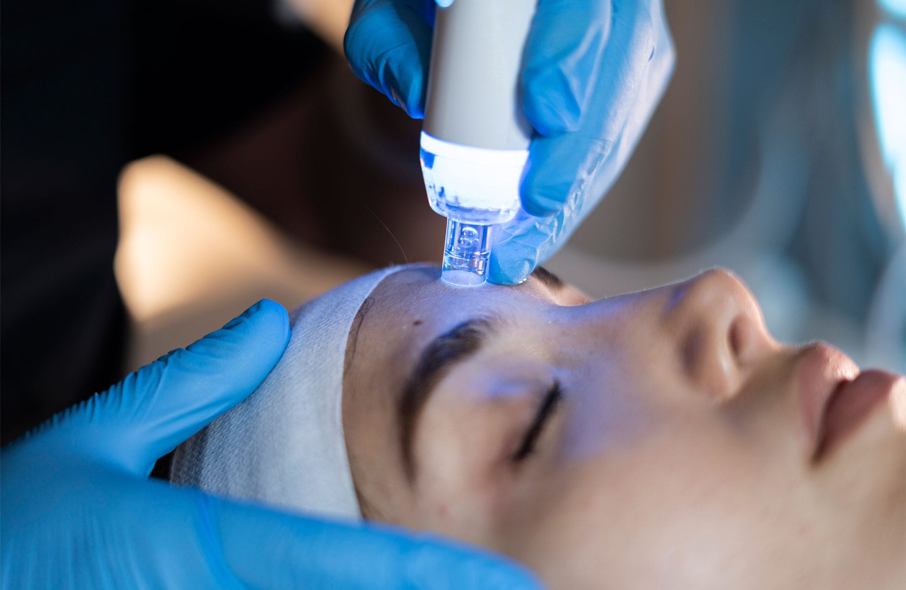 Tratamientos: ALATO SMART H2O LIMPIEZA PROFUNDA / DEEP CLEAN.