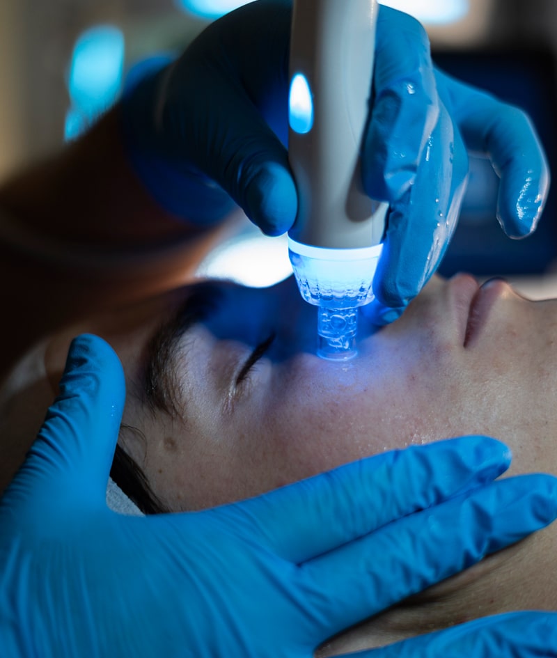 Tratamientos: ALATO SMART H2O LIMPIEZA PROFUNDA / DEEP CLEAN-5