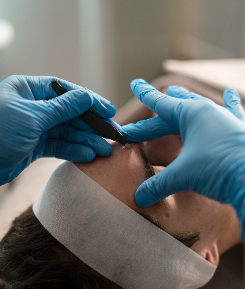 Tratamientos ALATO: MEN’S EYEBROW.