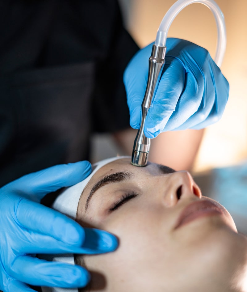 Tratamientos Alato: MICRODERMABRASION: LIMPIEZA PROFUNDA / DEEP CLEAN-1