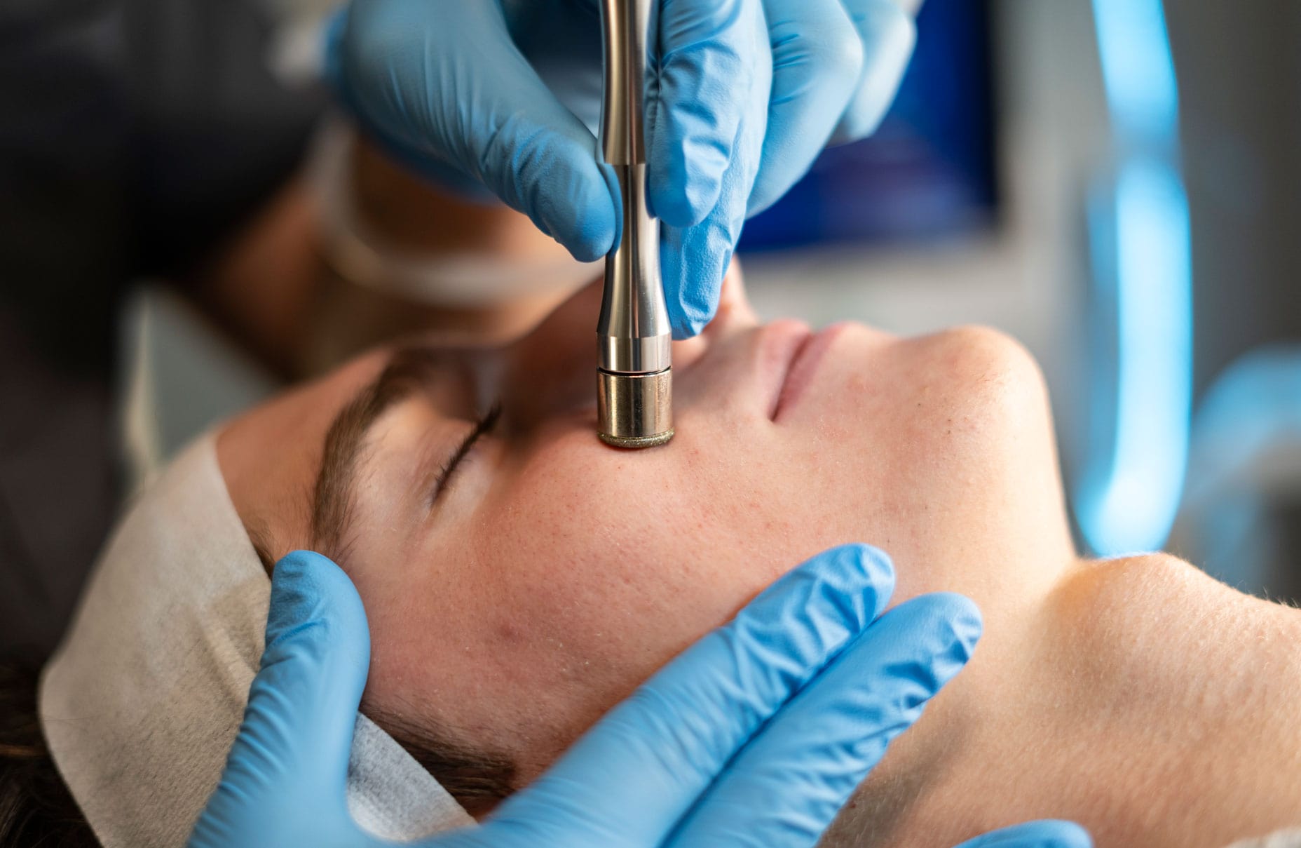 Tratamientos Alato: MICRODERMABRASION: LIMPIEZA PROFUNDA / DEEP CLEAN-2