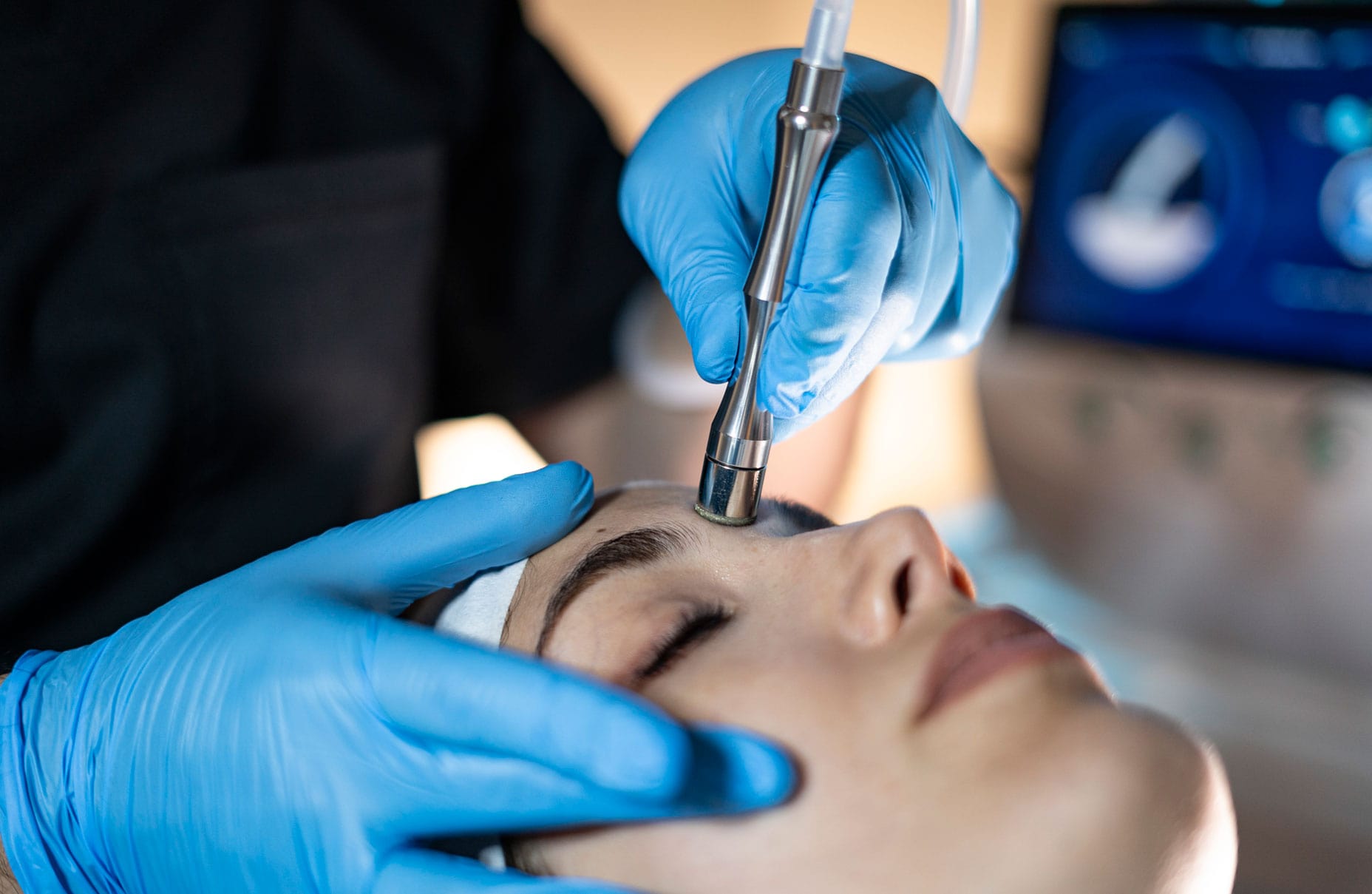 Tratamientos Alato: MICRODERMABRASION: LIMPIEZA PROFUNDA / DEEP CLEAN-3