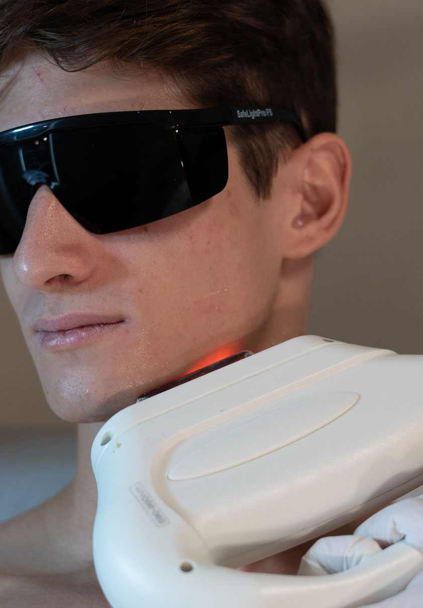 Tratamientos ALATO: ALATO LÁSER SHR. Elimina el vello no deseado de tu cuerpo sin sentir dolor.