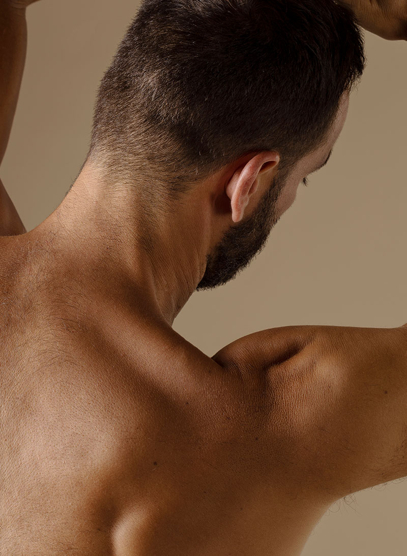 Tratamientos Alato: BACNE TREATMENT