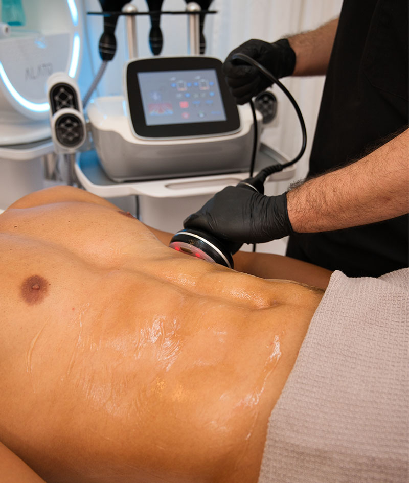 Tratamientos ALATO: ULTRA RADIOFRECUENCIA – CAVITACIÓN.